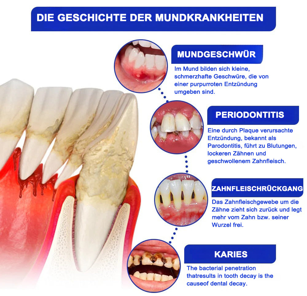 𝗗𝗼𝗯𝘀𝗵𝗼𝘄® 𝗕𝗶𝗲𝗻𝗲𝗻𝗴𝗶𝗳𝘁 𝗗𝗲𝗻𝘁𝗮𝗹𝗠𝗶𝗸𝗿𝗼𝗴𝗿𝗮𝗻𝘂𝗹𝗮𝘁 (🇩🇪 🦷 Zugelassen)
