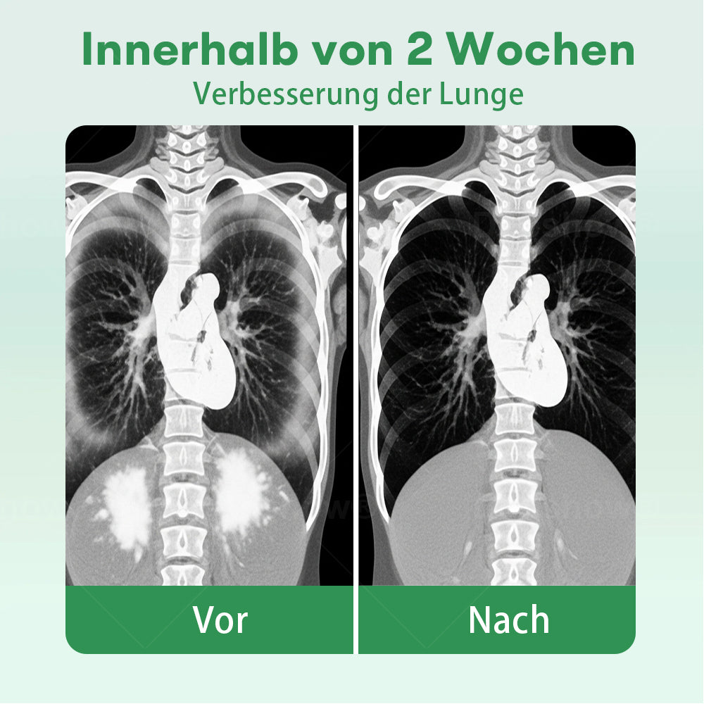 ✅Offizielles Geschäft|Cvreoz® Kräuter-Lungenreinigung Inhalieren(🫁Husten, Keuchen, Kurzatmigkeit, Auswurf, verstopfte Nase, Bronchitis, Bronchitis, Allergiesymptome, Lungenbeschwerden