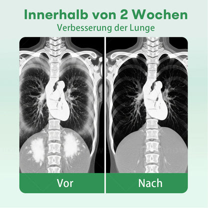 ✅Offizielles Geschäft|Cvreoz® Kräuter-Lungenreinigung Inhalieren(🫁Husten, Keuchen, Kurzatmigkeit, Auswurf, verstopfte Nase, Bronchitis, Bronchitis, Allergiesymptome, Lungenbeschwerden