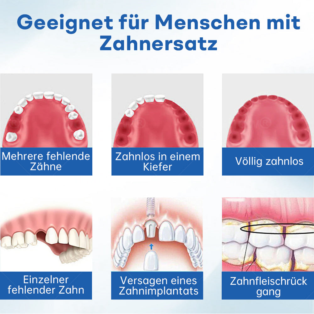 Nurbini® ThermoSeal Fresh Zahnprothesen- - ✅ Klinisch erwiesen, um Prothesenrutschen und -beschwerden vollständig zu lösen!