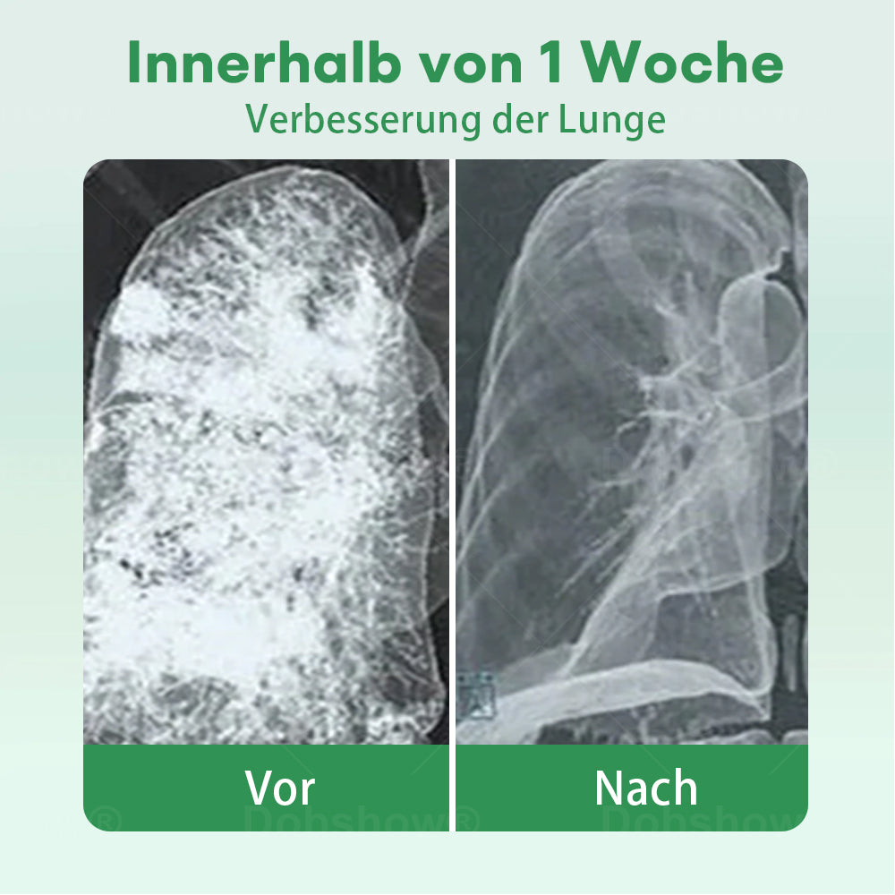 ✅Offizielles Geschäft|Cvreoz® Kräuter-Lungenreinigung Inhalieren(🫁Husten, Keuchen, Kurzatmigkeit, Auswurf, verstopfte Nase, Bronchitis, Bronchitis, Allergiesymptome, Lungenbeschwerden