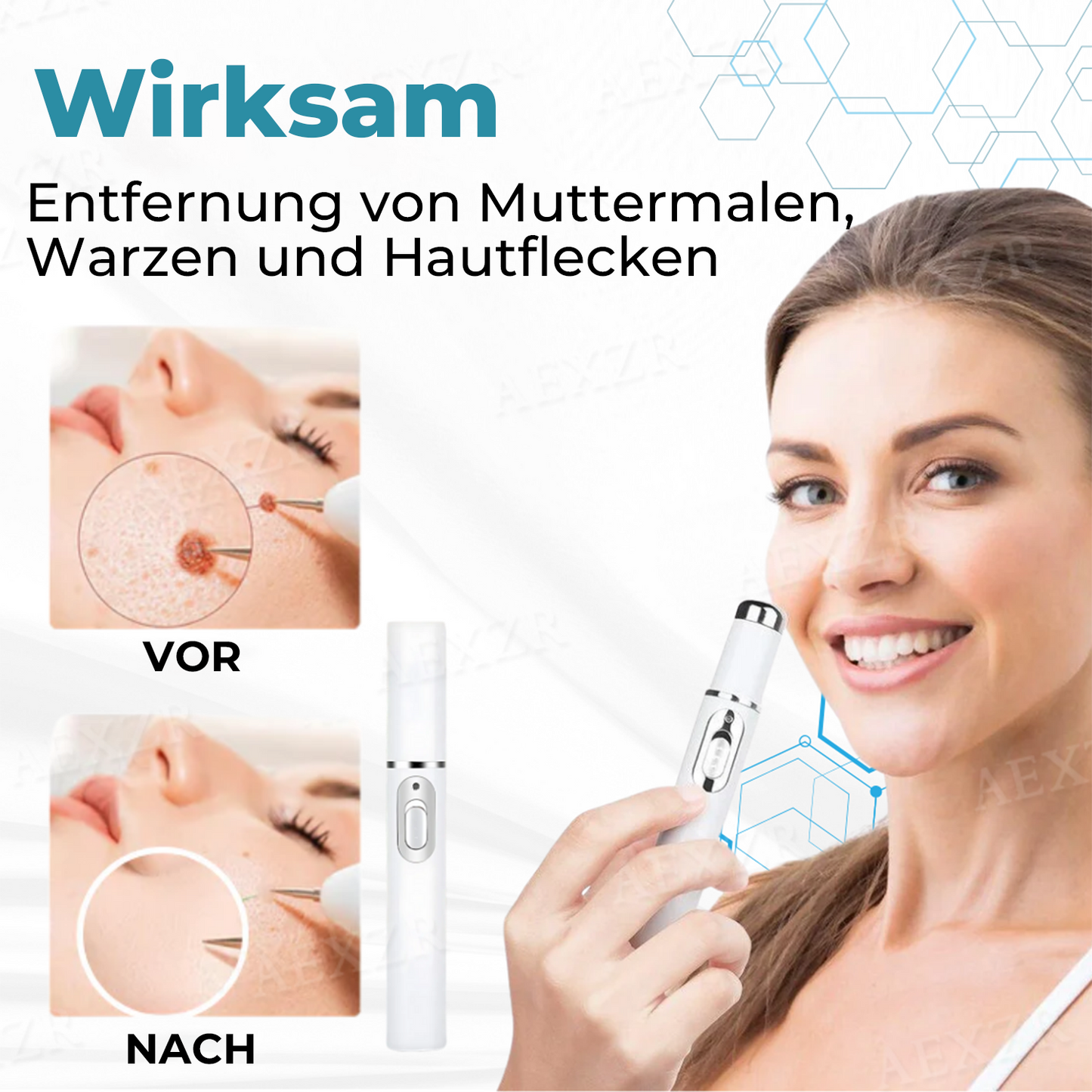 ✨𝗡𝘂𝗿𝗯𝗶𝗻𝗶® 𝗡𝗶𝗰𝗵𝘁-𝗶𝗻𝘃𝗮𝘀𝗶𝘃𝗲𝗿 𝗟𝗮𝘀𝗲𝗿-𝗦𝘁𝗶𝗳𝘁 𝘇𝘂𝗿 𝗘𝗻𝘁𝗳𝗲𝗿𝗻𝘂𝗻𝗴 𝘃𝗼𝗻 𝗠𝘂𝘁𝘁𝗲𝗿𝗺𝗮𝗹𝗲𝗻 𝘂𝗻𝗱 𝗪𝗮𝗿𝘇𝗲𝗻