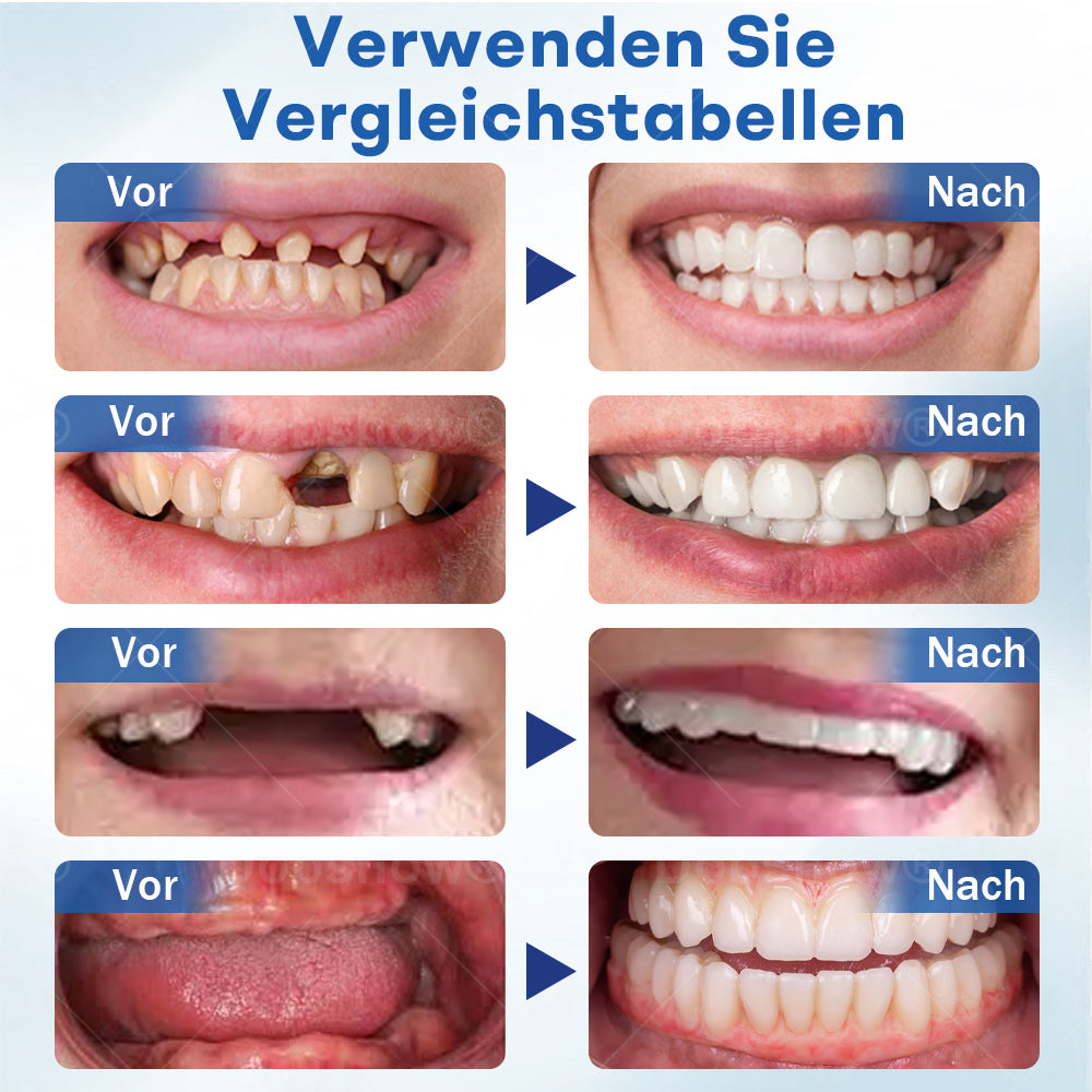 Nurbini® ThermoSeal Fresh Zahnprothesen- - ✅ Klinisch erwiesen, um Prothesenrutschen und -beschwerden vollständig zu lösen!
