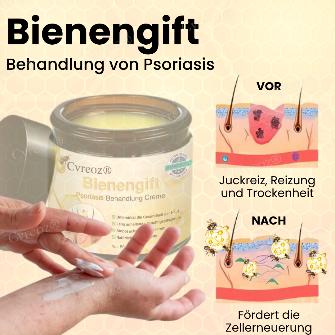 𝗖𝘃𝗿𝗲𝗼𝘇® 𝗕𝗶𝗲𝗻𝗲𝗻𝗴𝗶𝗳𝘁 𝗣𝘀𝗼𝗿𝗶𝗮𝘀𝗶𝘀 𝗕𝗲𝗵𝗮𝗻𝗱𝗹𝘂𝗻𝗴 𝗖𝗿𝗲𝗺𝗲